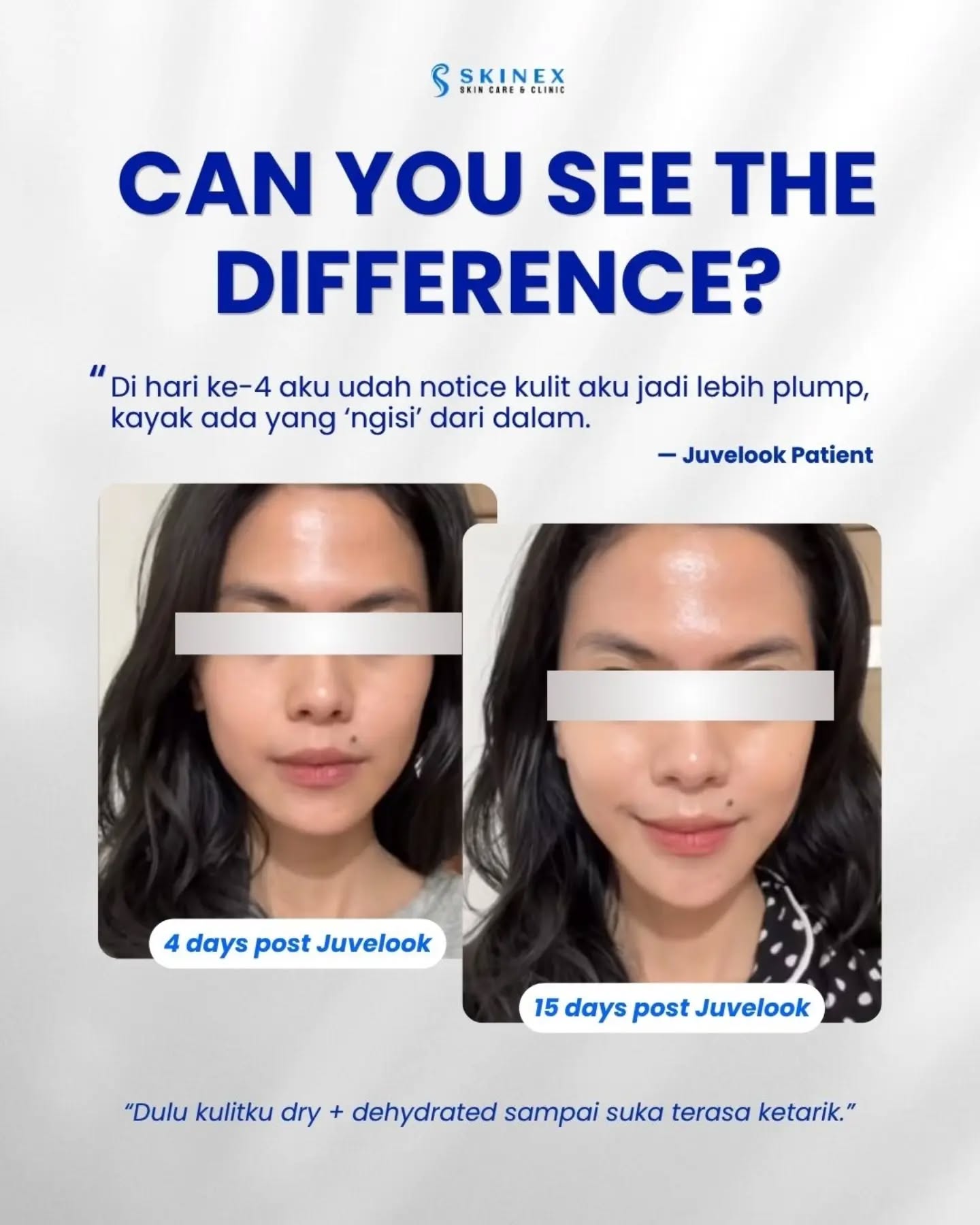Kok bisa kulit makin glowing setelah Juvelook?  Karena glow yang terlihat bukan cuma dari hidrasi di… (@skinexbintaro di Instagram)